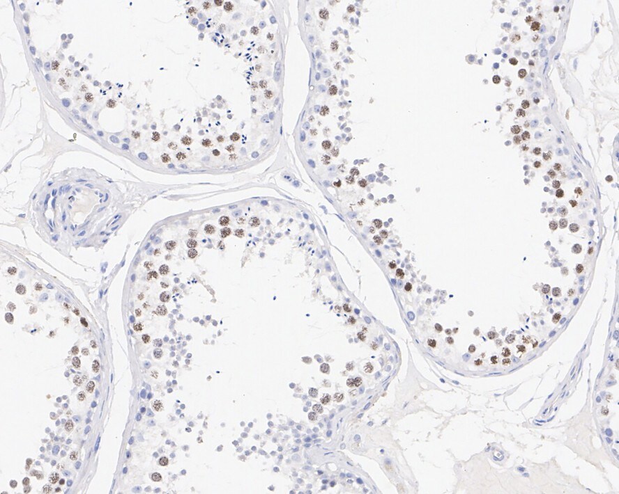 SCP3/SYCP3 Antibody (PSH02-24)