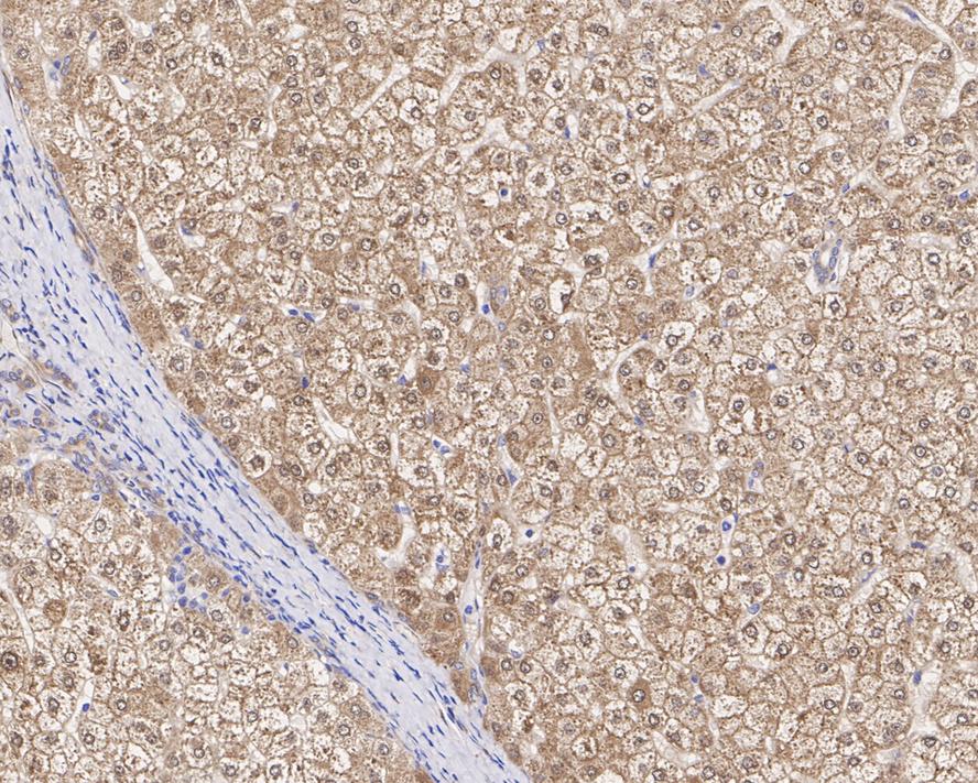 SEC14L2 Antibody (JE61-74)
