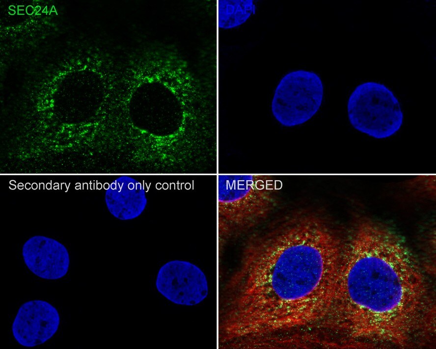 SEC24A Antibody (PSH04-36)