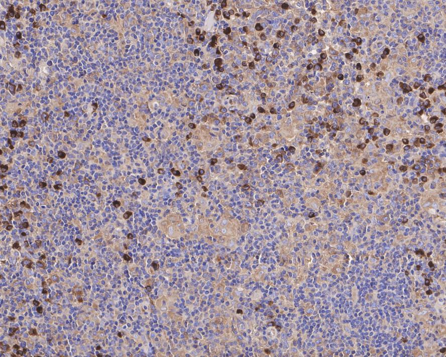 SEC24A Antibody (PSH04-36)