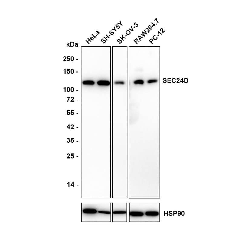 SEC24D Antibody (JE65-27) Western Blot: SEC24D Antibody (JE65-27) [NBP3-32937]