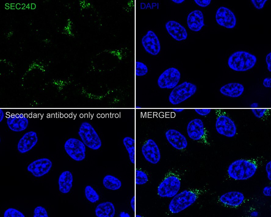 SEC24D Antibody (JE65-27)