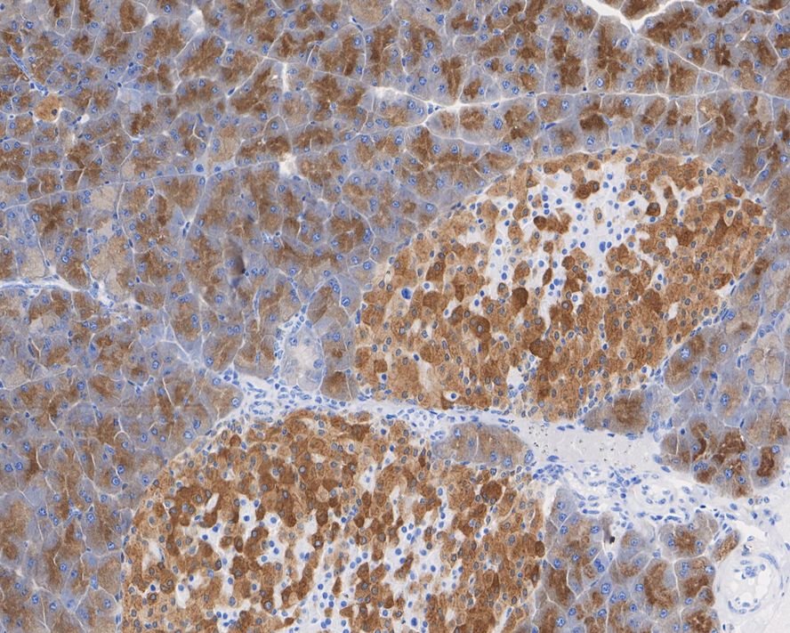 SEC24D Antibody (JE65-27)