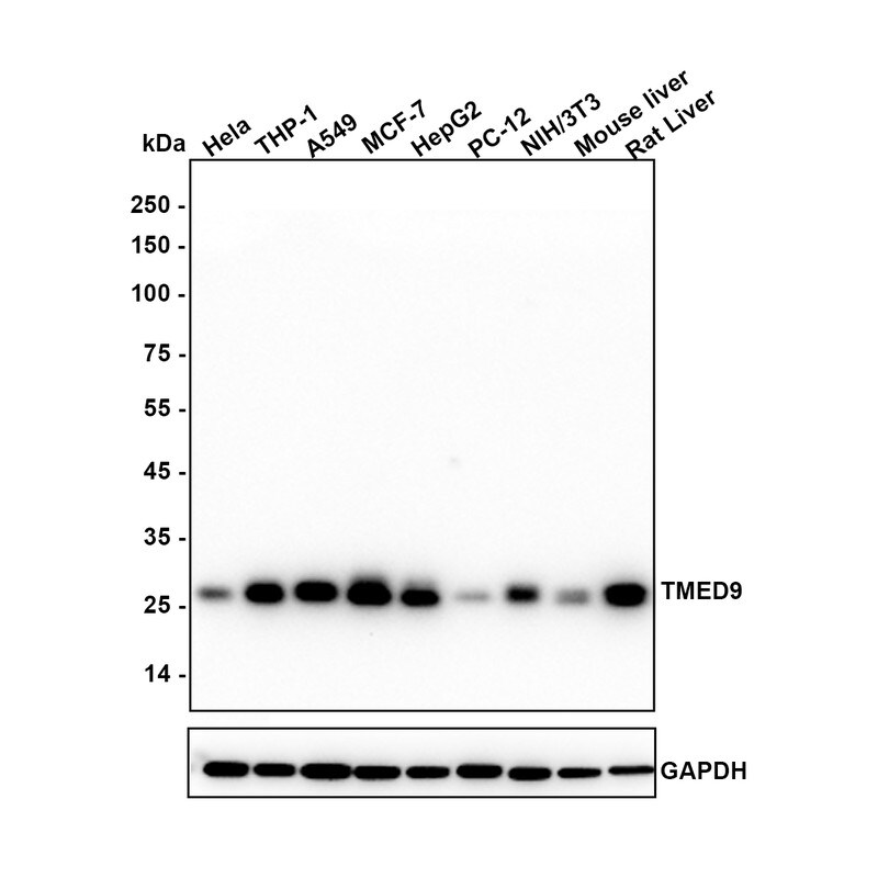 TMED9 Antibody (A9A7) Western Blot: TMED9 Antibody (A9A7) [NBP3-32938]