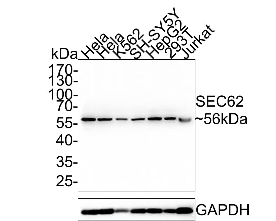 SEC62 Antibody (PSH0-25) Western Blot: SEC62 Antibody (PSH0-25) [NBP3-32939]