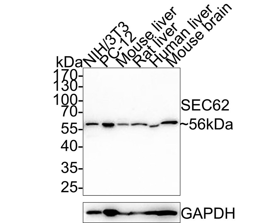 SEC62 Antibody (PSH0-25) Western Blot: SEC62 Antibody (PSH0-25) [NBP3-32939]