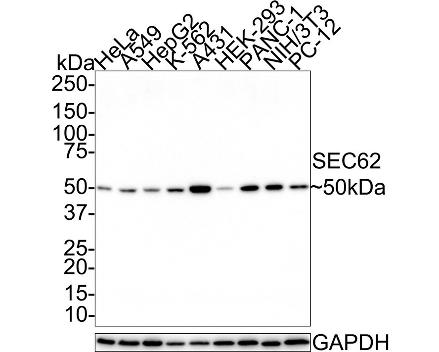 SEC62 Antibody (JE62-80)