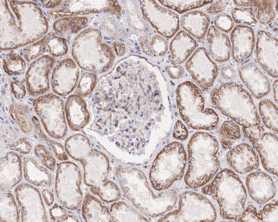SEC62 Antibody (JE62-80)