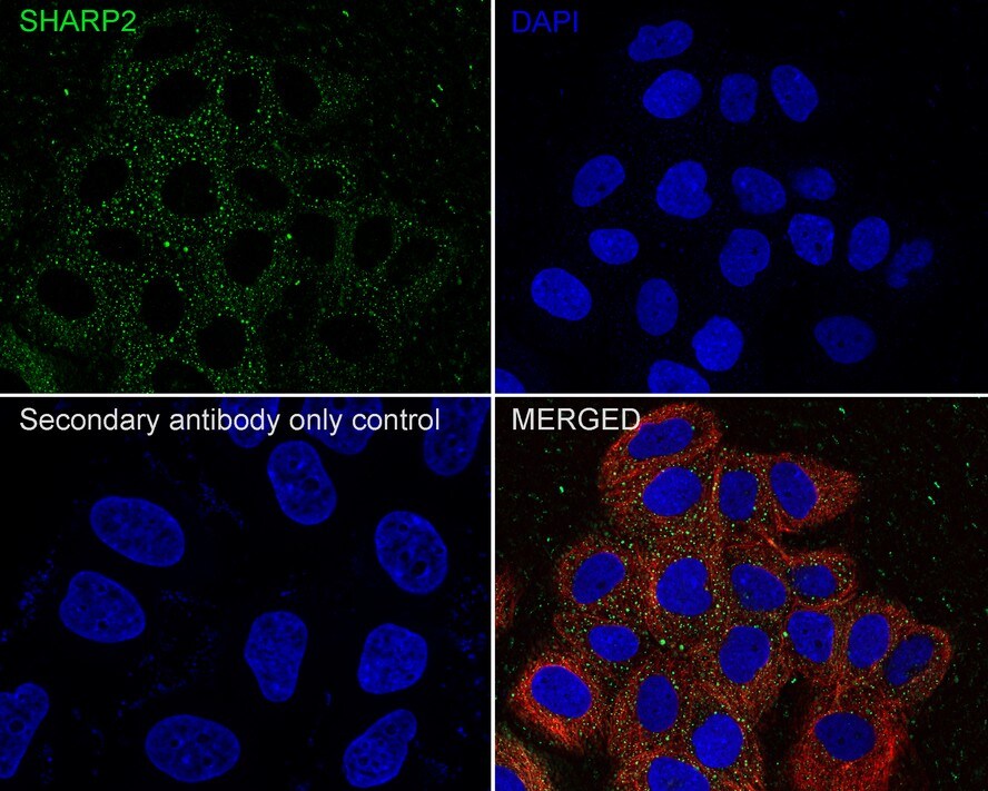 DEC1 Antibody (PSH01-90)