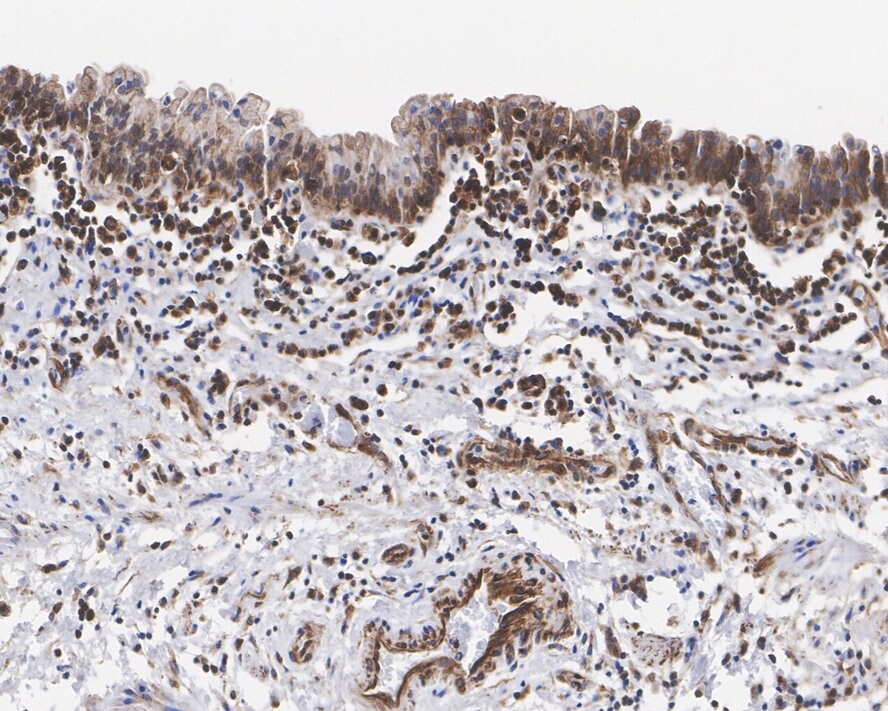 DEC1 Antibody (PSH01-90)