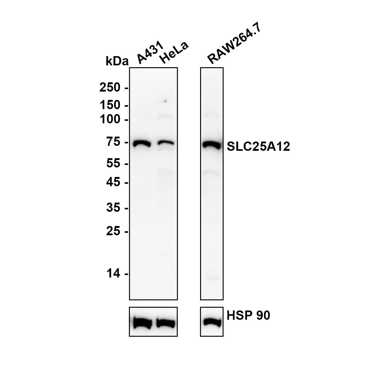 SLC25A12 Antibody (JE65-52) Western Blot: SLC25A12 Antibody (JE65-52) [NBP3-32952]
