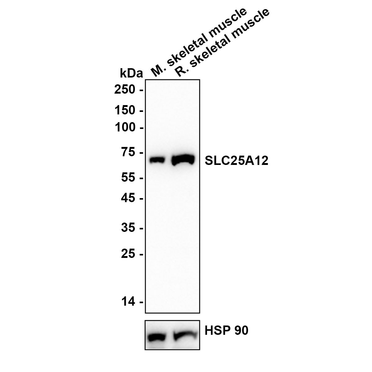 SLC25A12 Antibody (JE65-52) Western Blot: SLC25A12 Antibody (JE65-52) [NBP3-32952]