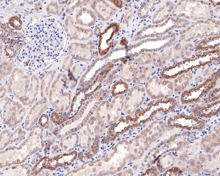SLC25A12 Antibody (JE65-52)