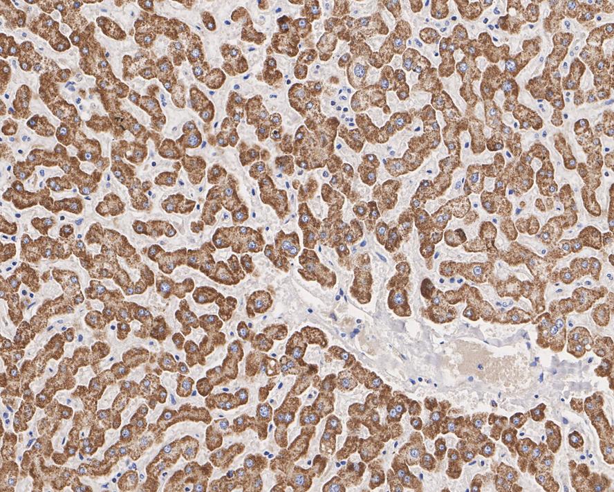 SLC25A38 Antibody (PSH02-79)