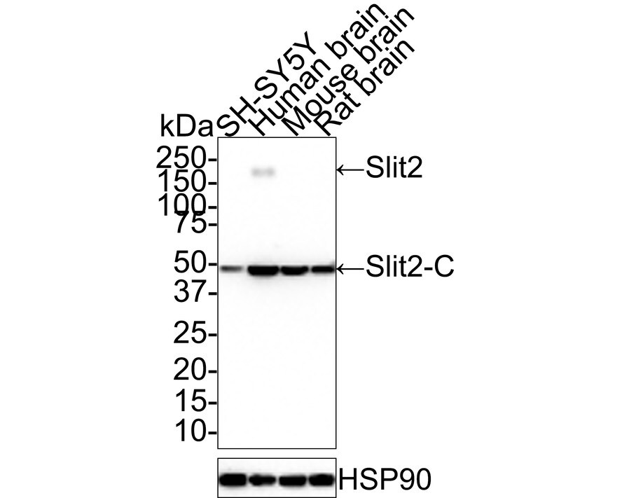 Slit2 Antibody (JE31-87) Western Blot: Slit2 Antibody (JE31-87) [NBP3-32955]