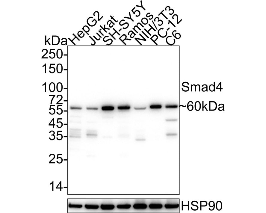 Smad4 Antibody (PD01-37) Western Blot: Smad4 Antibody (PD01-37) [NBP3-32956]