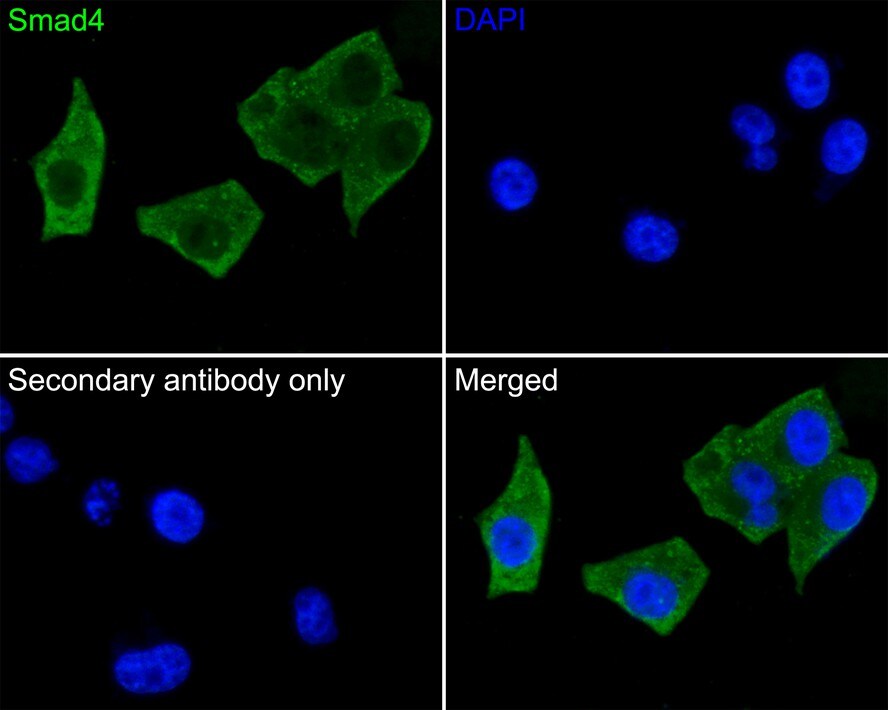 Smad4 Antibody (PD01-37)