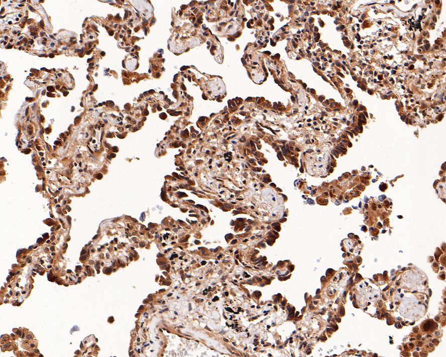 Smad4 Antibody (PD01-37)