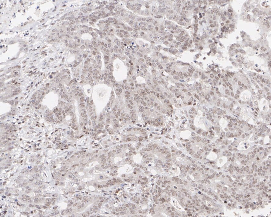 BRM Antibody (PSH01-15)