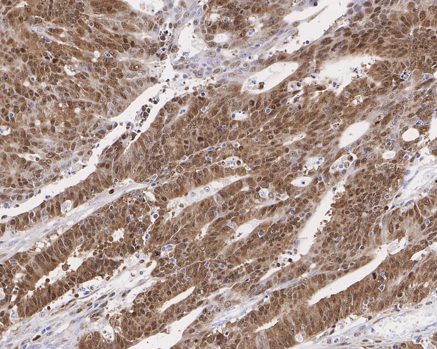 SMC2 Antibody (PSH0-62)