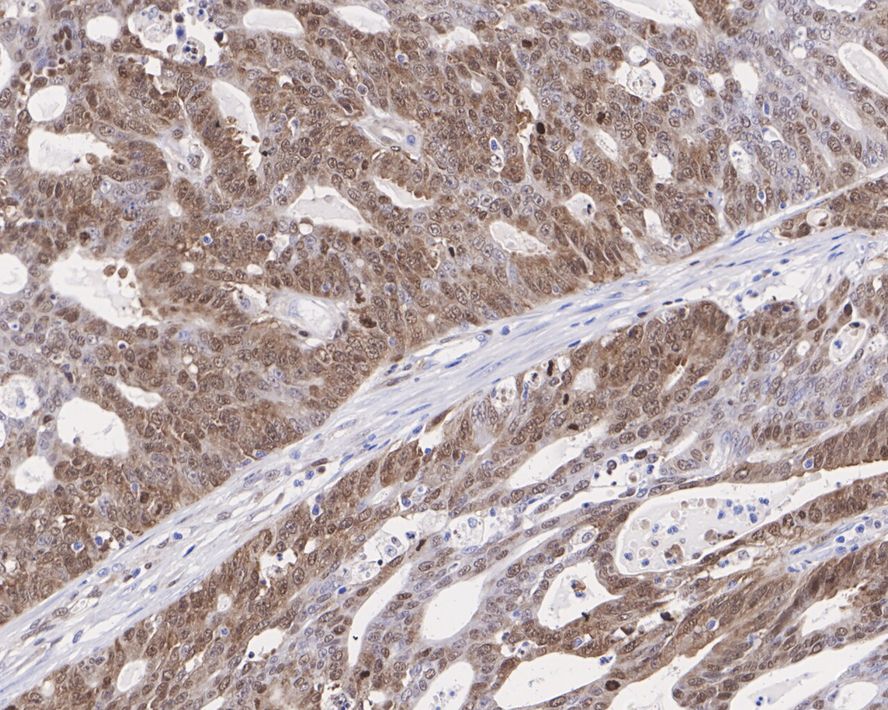 SMC2 Antibody (PSH0-63)