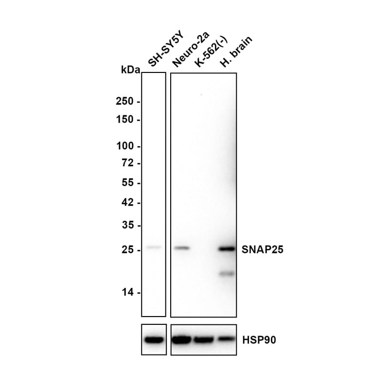SNAP25 Antibody (JE45-86) Western Blot: SNAP25 Antibody (JE45-86) [NBP3-32961]
