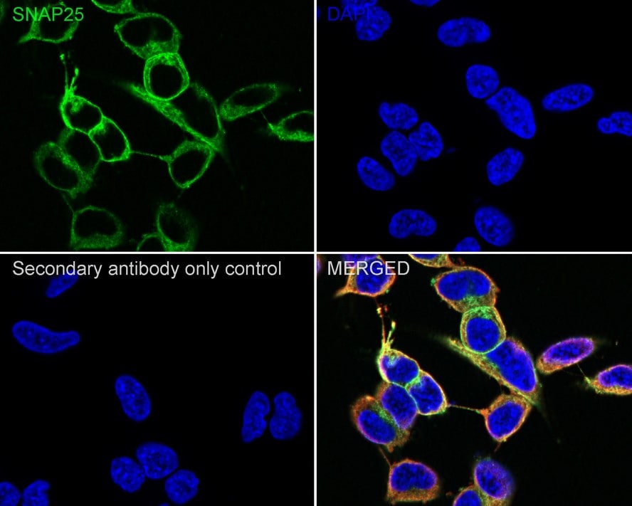 SNAP25 Antibody (JE45-86)