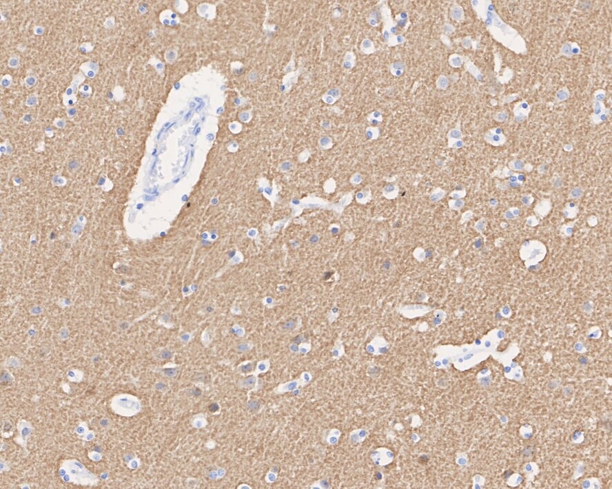 SNAP25 Antibody (JE45-86)