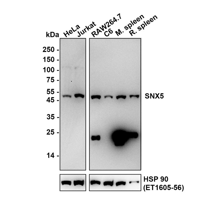 SNX5 Antibody (JE64-96) Western Blot: SNX5 Antibody (JE64-96) [NBP3-32965]
