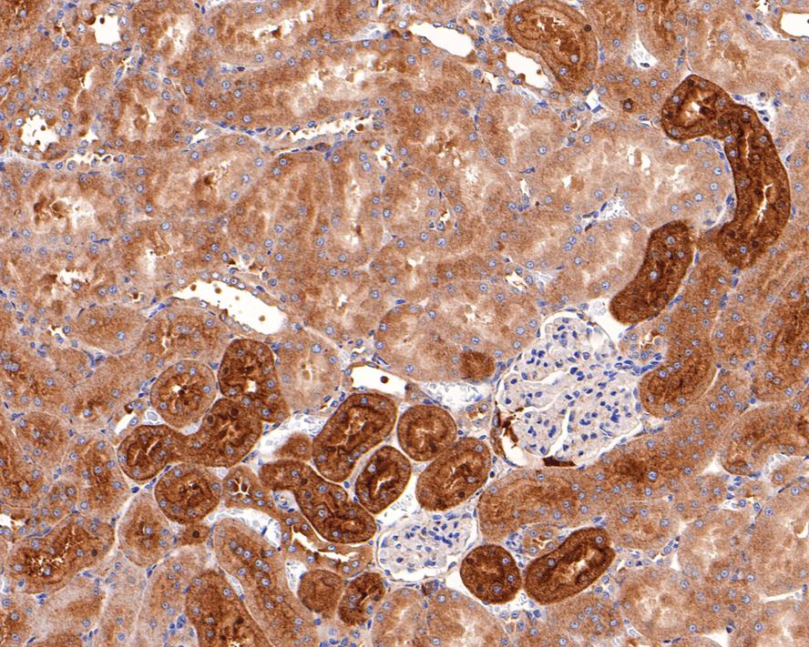 SNX5 Antibody (JE64-96)