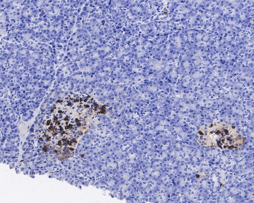 Somatostatin 28 Antibody (JE43-52)