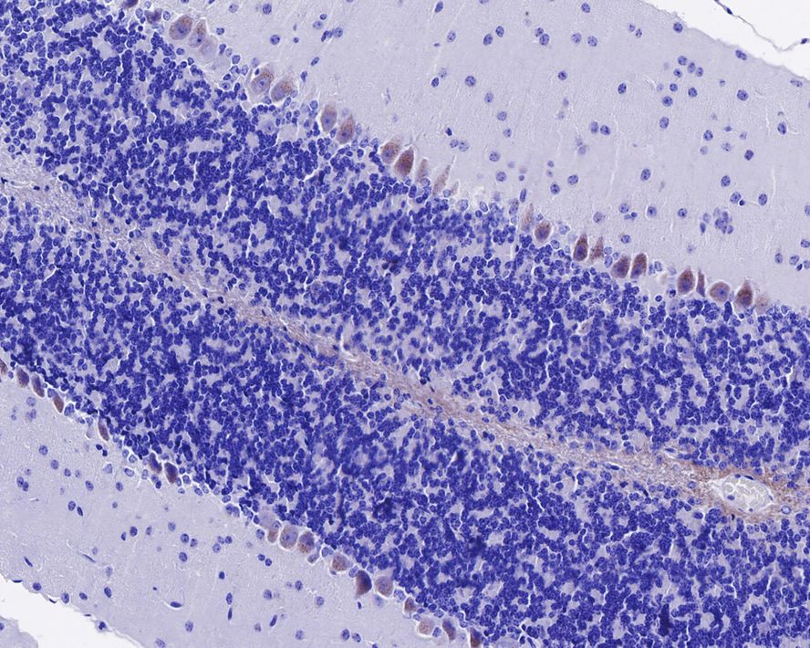 SorLA Antibody (JE35-52)