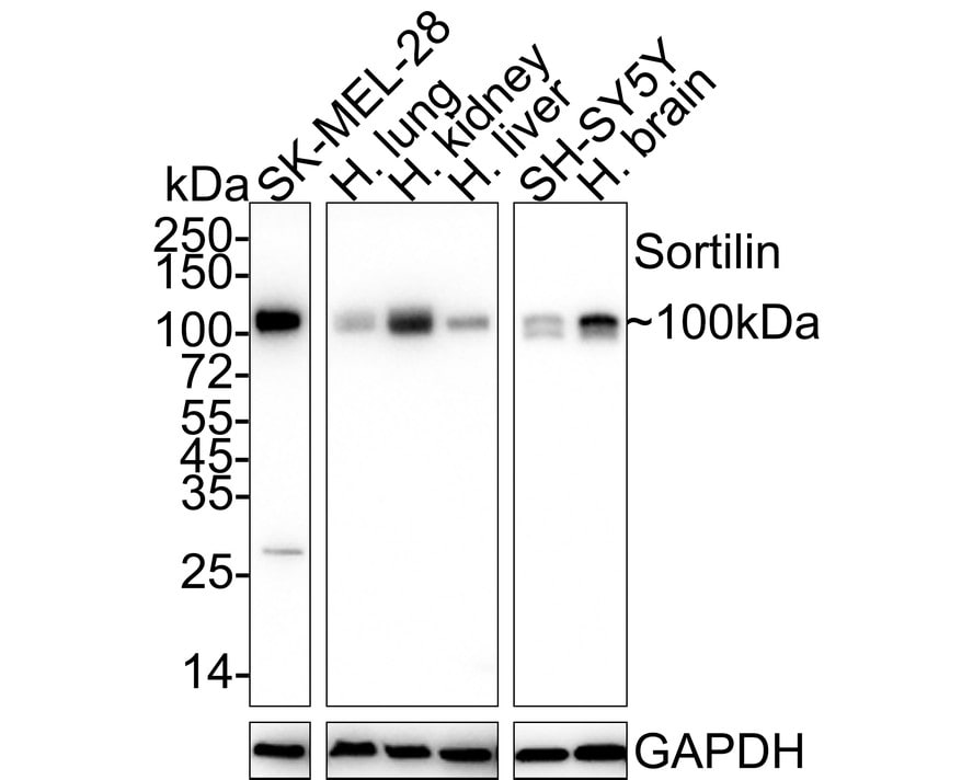 Sortilin Antibody (JE60-00) Western Blot: Sortilin Antibody (JE60-00) [NBP3-32968]
