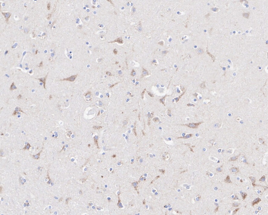 Sortilin Antibody (JE60-00)