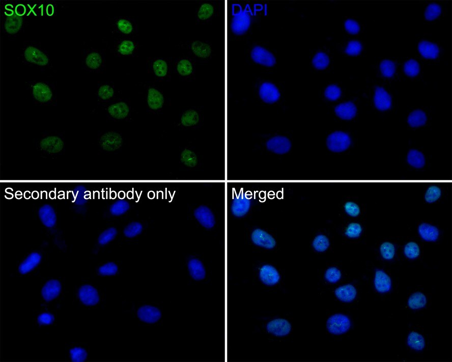 SOX10 Antibody (PDH0-05)