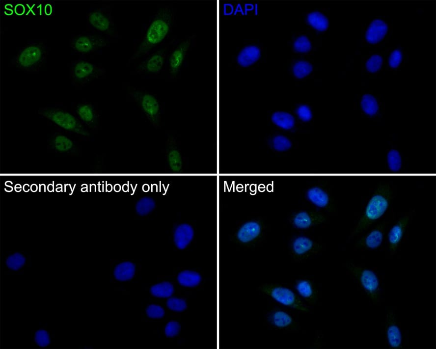 SOX10 Antibody (PDH0-03)
