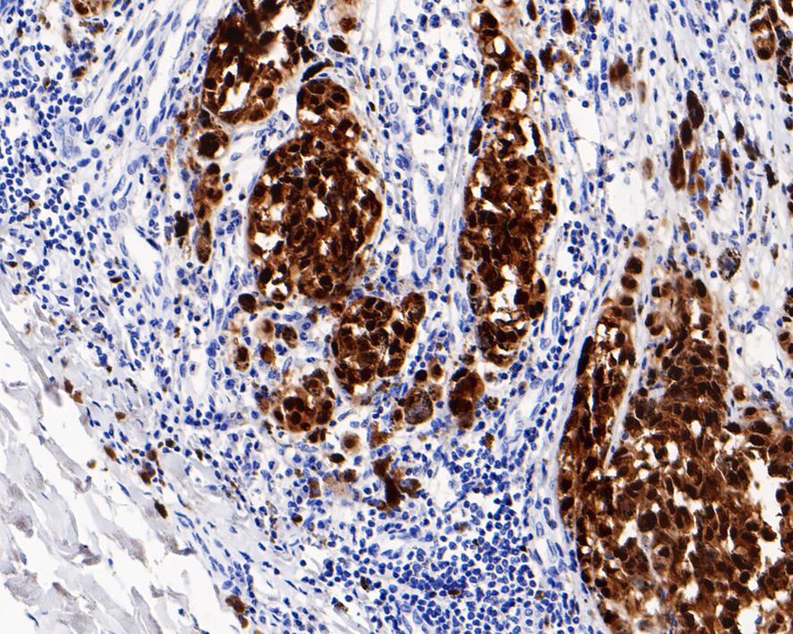 SOX10 Antibody (PDH0-03)