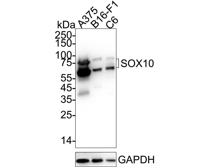 SOX10 Antibody (PDH0-04) Western Blot: SOX10 Antibody (PDH0-04) [NBP3-32971]