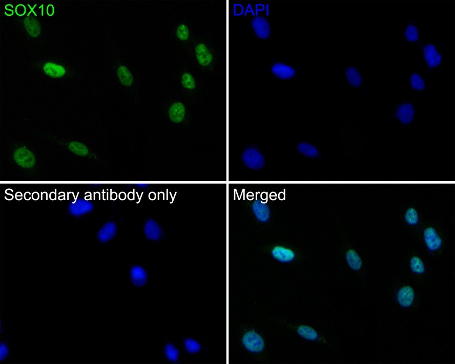 SOX10 Antibody (PDH0-04)