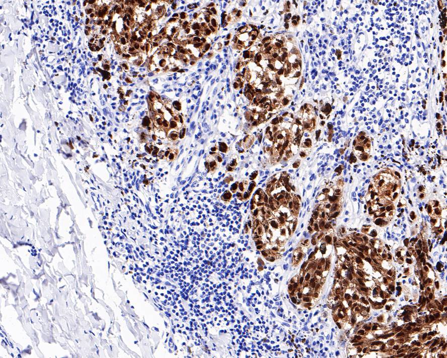 SOX10 Antibody (PDH0-04)