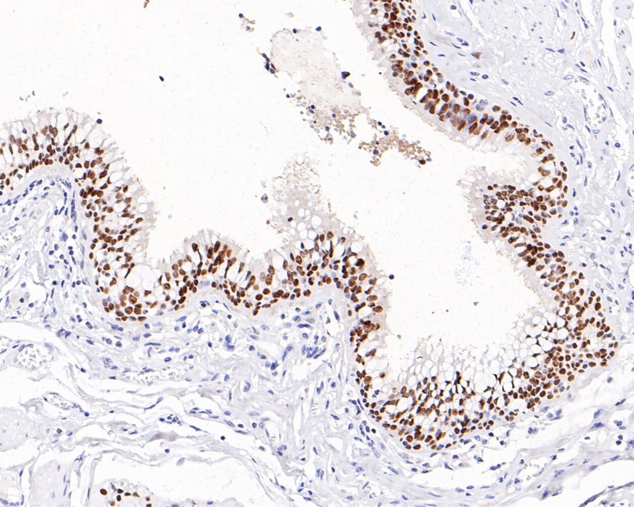 SOX2 Antibody (PO00-28)