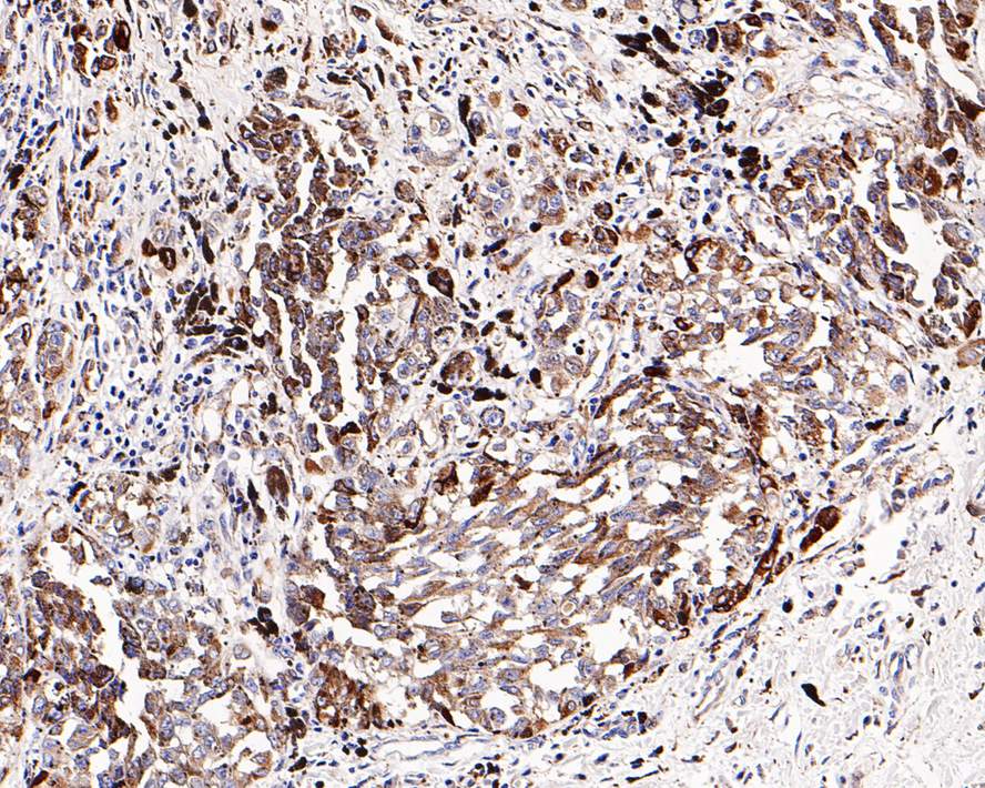 SPARC Antibody (PD00-57)