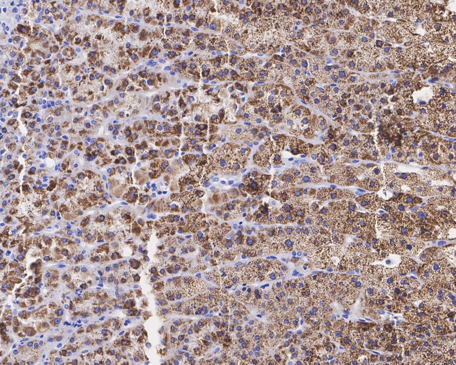 StAR Antibody (JE32-23)
