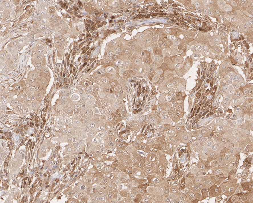 STAT1 Antibody (G3-B11-R)