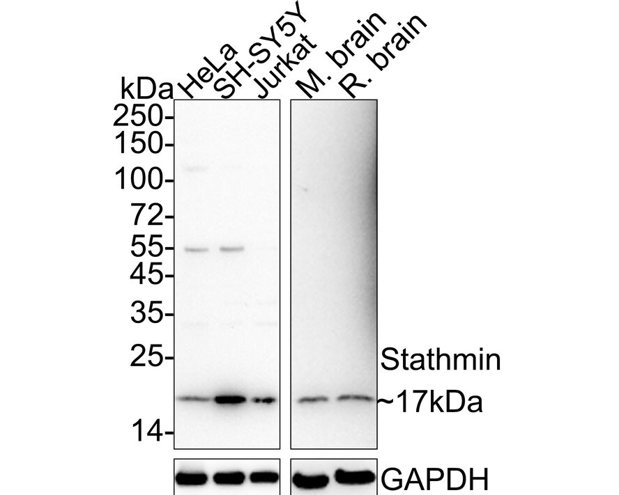 Stathmin 1 Antibody (PD00-54) Western Blot: Stathmin 1 Antibody (PD00-54) [NBP3-32981]