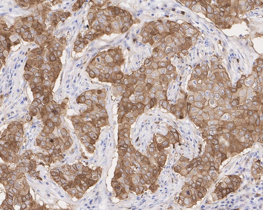 Stathmin 1 Antibody (PD00-54)