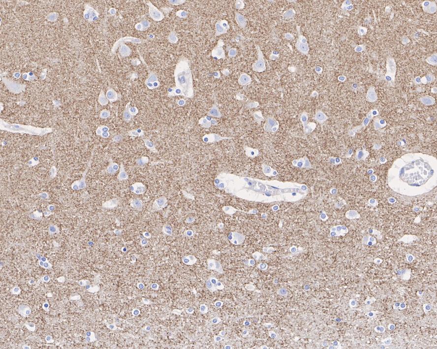 Synaptophysin Antibody (JE42-51)