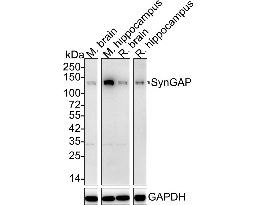 SynGAP Antibody (JE57-79) Western Blot: SynGAP Antibody (JE57-79) [NBP3-32988]