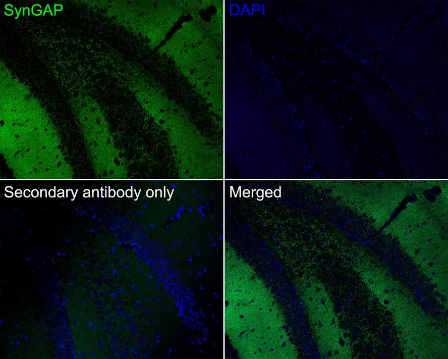 SynGAP Antibody (JE57-79)