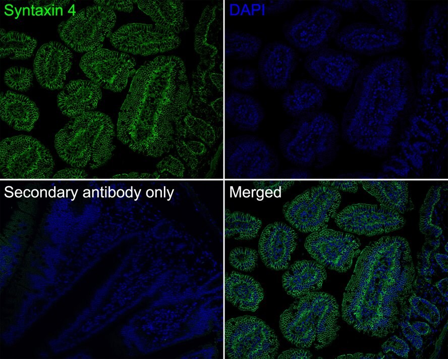 Syntaxin 4 Antibody (PSH0-80)